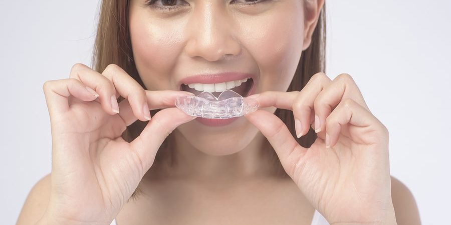 Invisalign – Archer Dental